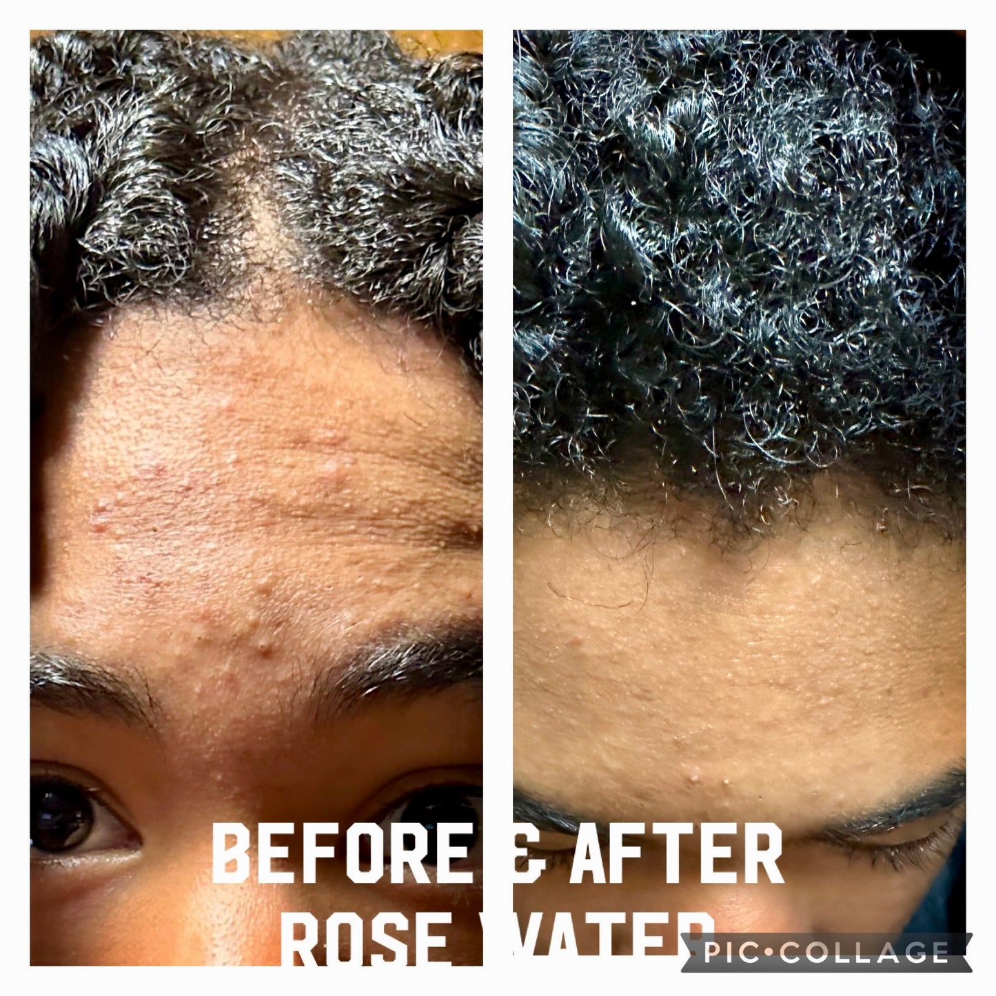 Rose Water/Hydrosol - Preservative Free with Vitamin E -Unisex. Daily Skin Toner-Hydrator and Great Hair & Scalp Moisturizer.